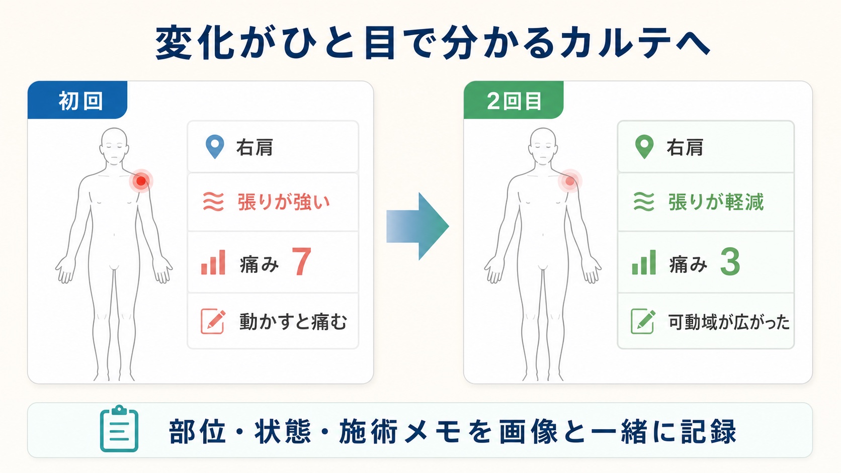 右肩の痛みが初回7から2回目3へ変化したマルチカルテの記録例